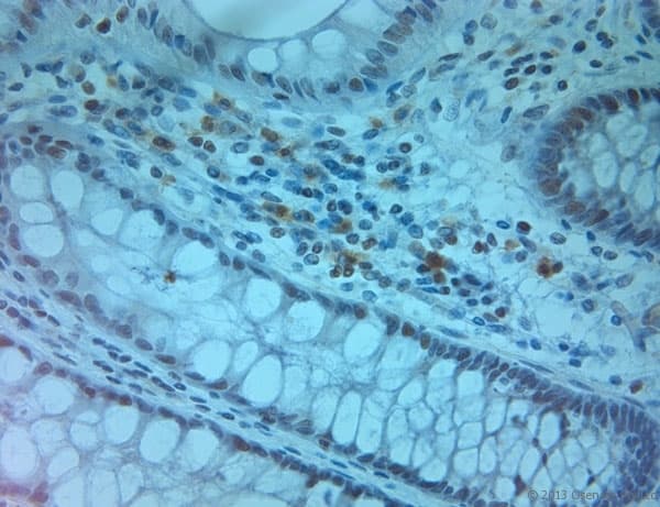 SLC11A2 / DMT1 Antibody