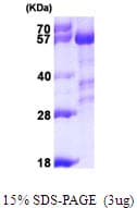 Human PPP3CA / CCN1 / Calcineurin A Protein (Recombinant His)