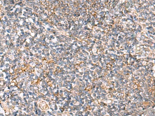 Polyclonal Rabbit anti-Human HLA-DOB Antibody (IHC, WB)