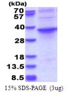 Human ASPHD1 Protein (Recombinant His)
