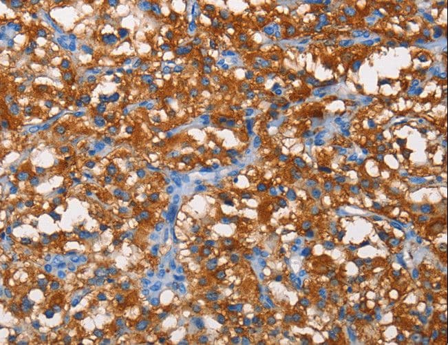 Polyclonal Rabbit anti-Human PFKP Antibody (IHC, WB)