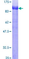 Human EZR / Ezrin Protein (Recombinant GST)