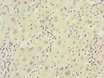 FBXO22 Antibody