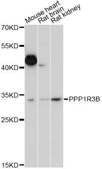 Polyclonal Rabbit anti-Human PPP1R3B Antibody (WB)