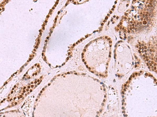 Cullin 4A / CUL4A Antibody
