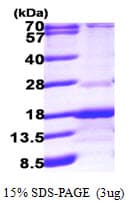Human RABIF Protein (Recombinant His)