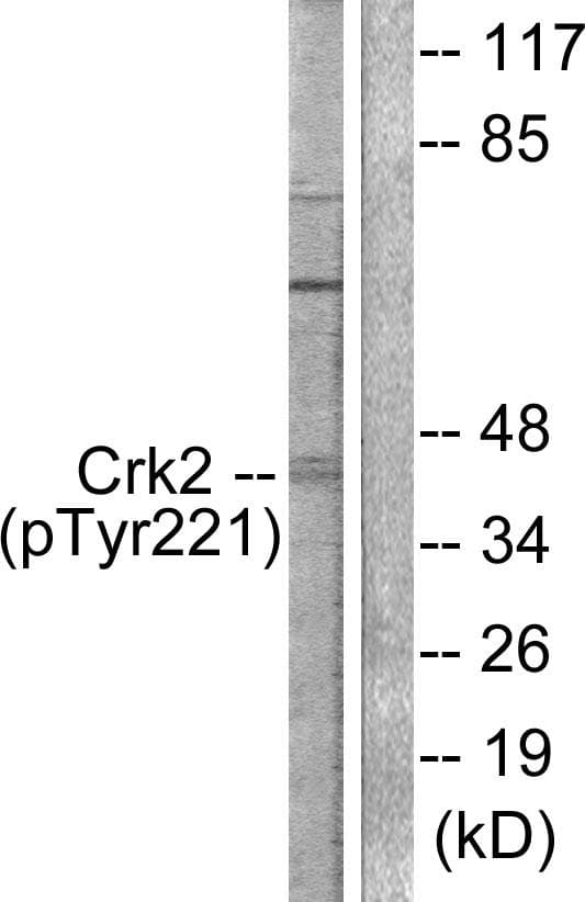 Polyclonal Rabbit anti-Human CRK Antibody (phospho-Tyr221, IF, WB)