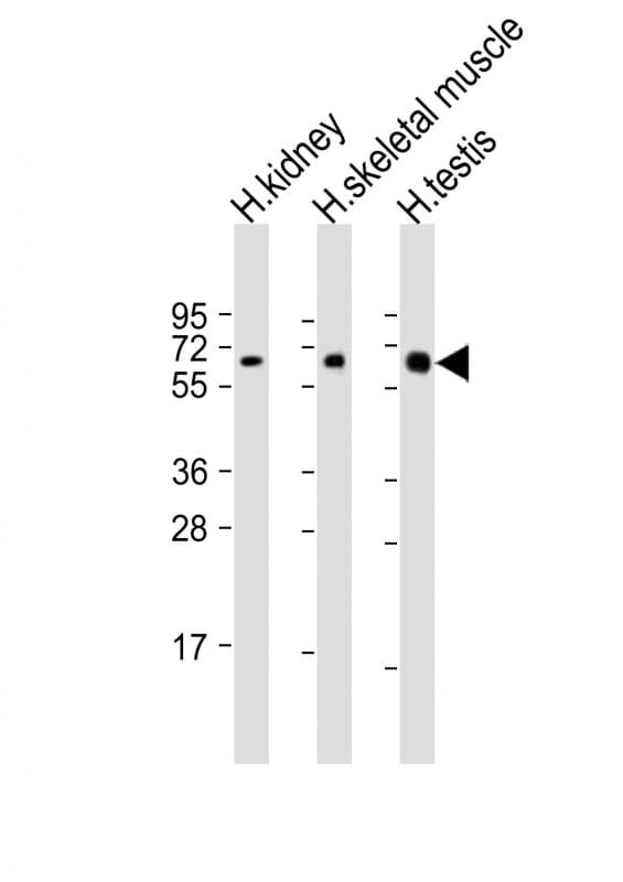 DMRT2 Antibody (aa357-392)