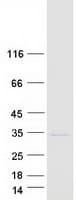Human FGF14 Protein (Recombinant Myc-DDK (Flag))