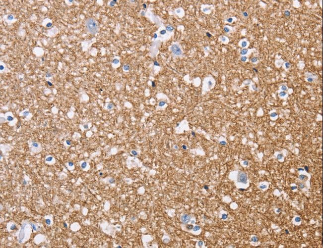 MAG Antibody