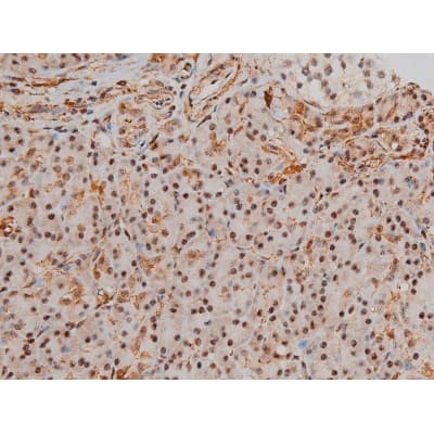 Polyclonal Rabbit anti-Human FLNA / Filamin A Antibody (phospho-Ser2152, IHC, IF, WB)