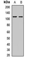 Polyclonal Rabbit anti-Human HERC3 Antibody (IHC, WB)