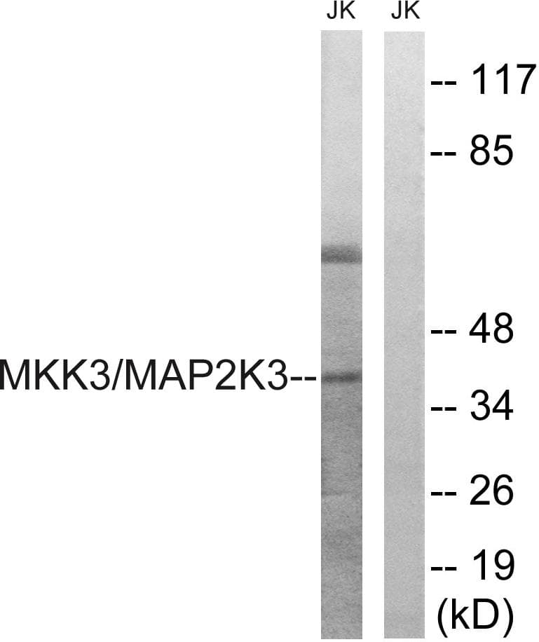 MAP2K3 / MEK3 / MKK3 Antibody (p222)