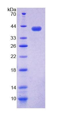 Human NAP1L1 Protein (Recombinant His-T7)