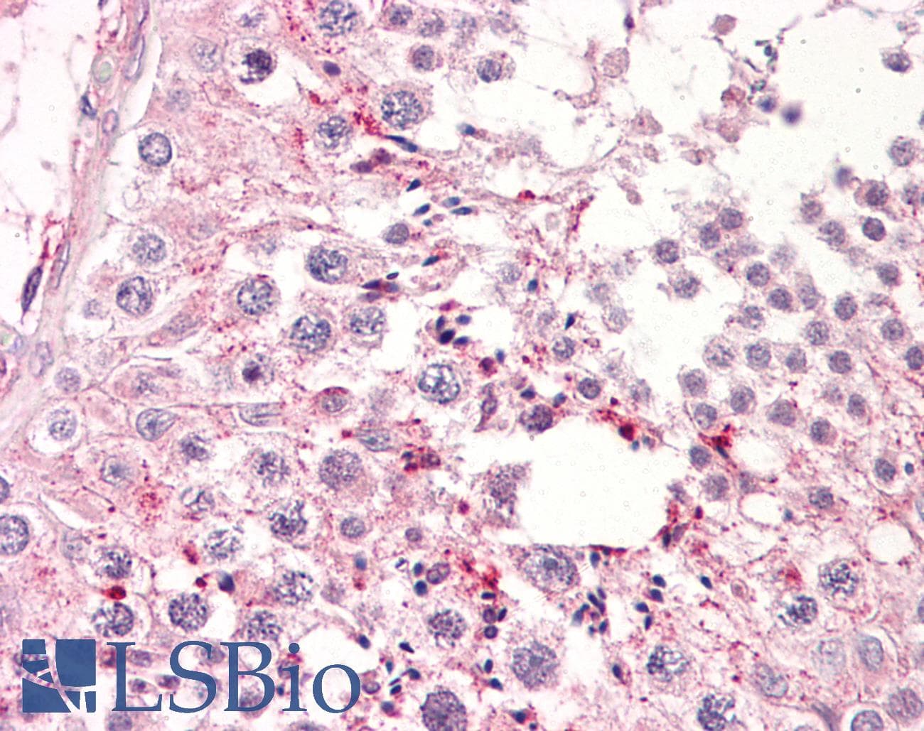 IHC-plus™ MTOR Antibody (aa2447-2496)
