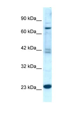 RGS10 Antibody (C-Terminus)
