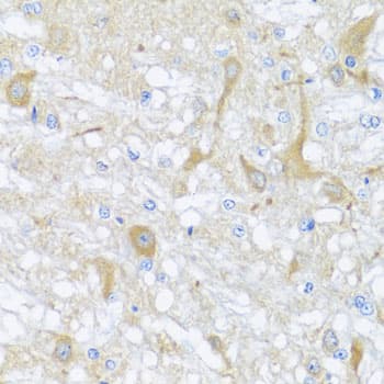 SULT1A1 / Sulfotransferase 1A1 Antibody
