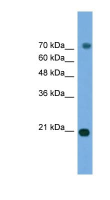 Polyclonal Rabbit anti-Human MAPK6 / ERK3 Antibody (aa395-444, WB)
