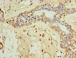Polyclonal Rabbit anti-Human IL28B Antibody (aa22-196, IHC)