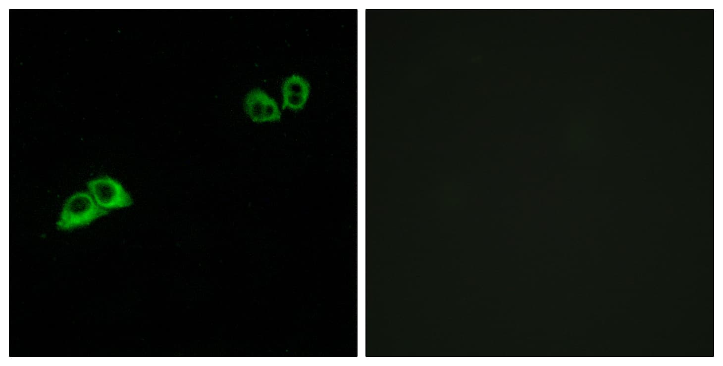 OR2AT4 Antibody (aa271-320)