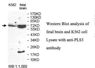 Polyclonal Rabbit anti-Human PLS3 / T Plastin Antibody (aa235-456, IHC, WB)