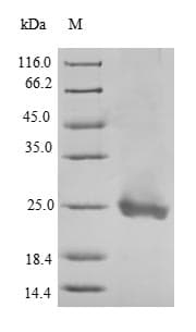 Human Scramblase / PLSCR1 Protein (Recombinant GST, N-terminus)