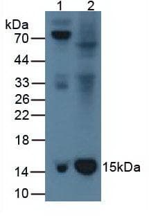 B2M / Beta 2 Microglobulin Antibody (clone A9)