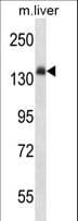 Polyclonal Rabbit anti-Mouse INSR / Insulin Receptor Antibody (aa546-574, WB)