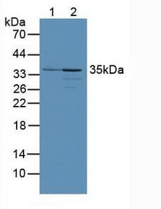 PINK1 Antibody (aa262-507, FITC)
