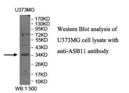 ASB11 Antibody (aa132-302)