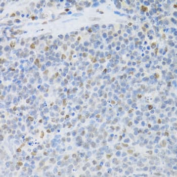 SFN / Stratifin / 14-3-3 Sigma Antibody