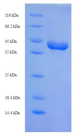 Rhizomucor miehei Lipase Protein (Recombinant His)