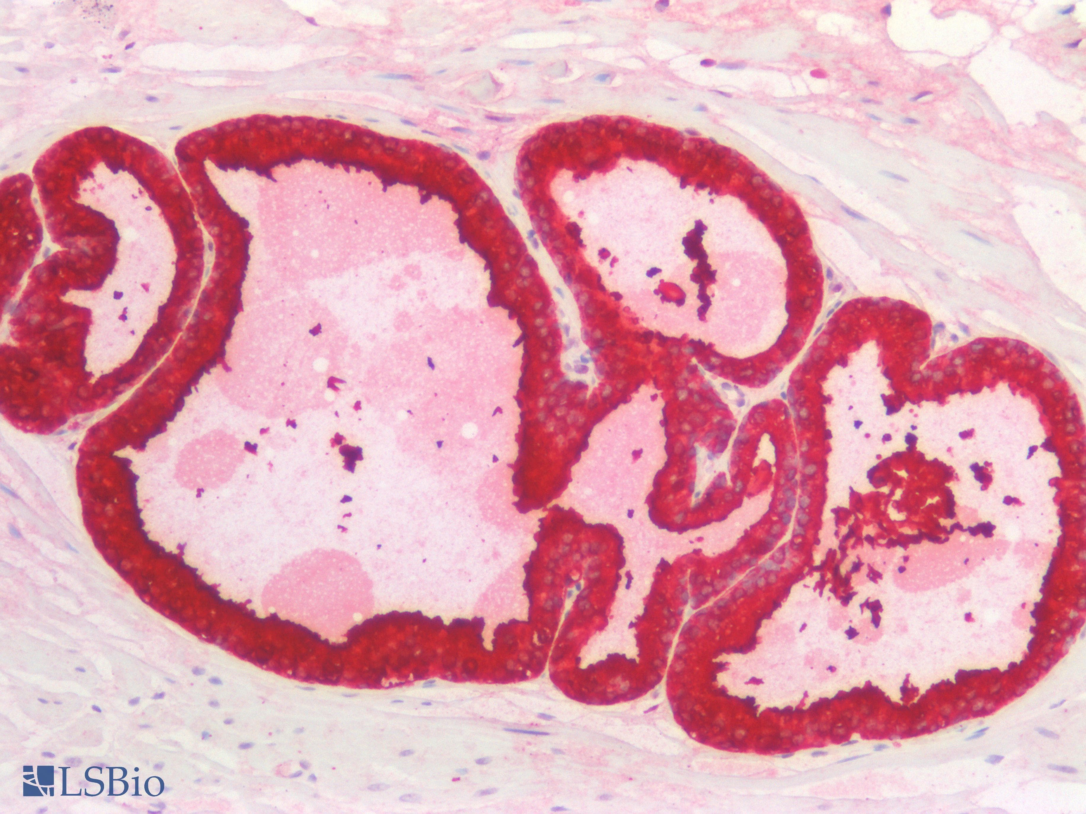 PathPlus™ KLK3 / PSA Antibody (Internal)
