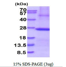Human PSMB8 / LMP7 Protein (Recombinant His)
