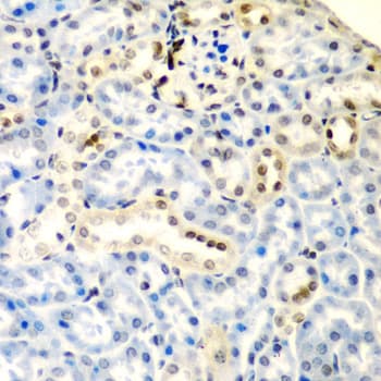 DDX1 Antibody