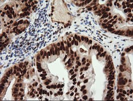 TRIM38 Antibody (clone OTI113D3)