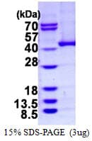 Human ADH5 Protein (Recombinant His)