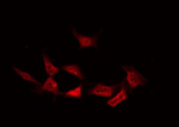 PRKCD / PKC-Delta Antibody (phospho-Tyr64)