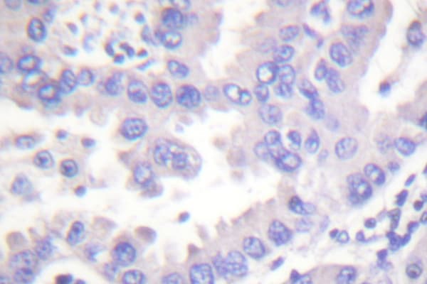 SYK Antibody (Pro342)
