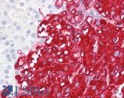 PathPlus™ TPH1 / Tryptophan Hydroxylase Antibody