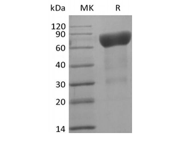 Human IL6R / IL6 Receptor Protein (Recombinant AVI-6His, C-terminus)