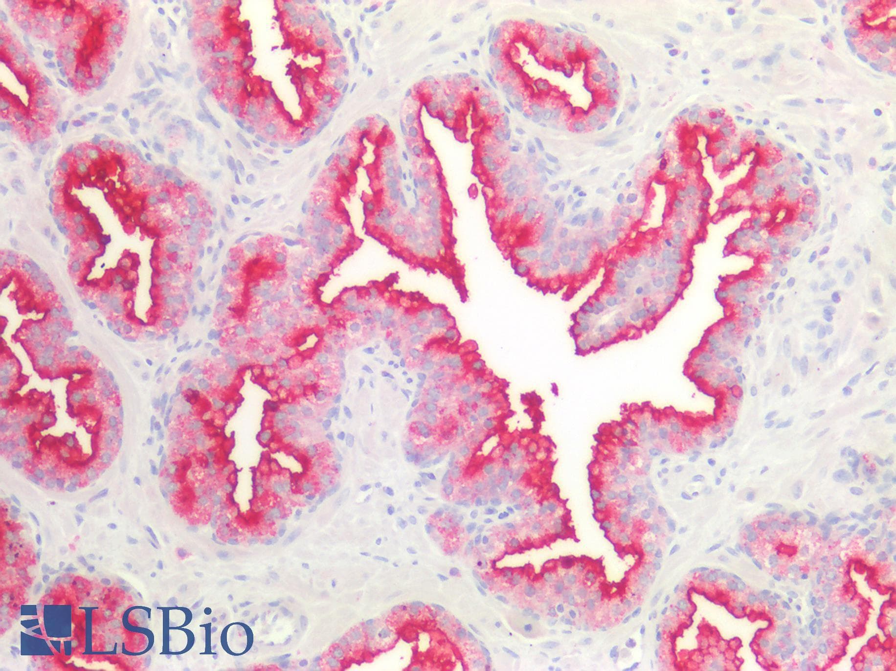 PathPlus™ MLPH / Melanophilin Antibody