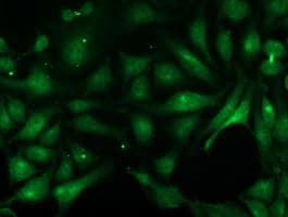 PNMT Antibody (clone OTI2D5)