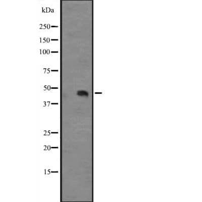 IL12B / IL12 p40 Antibody