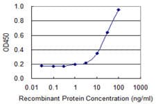 HSD3B2 Antibody (clone 1E8)