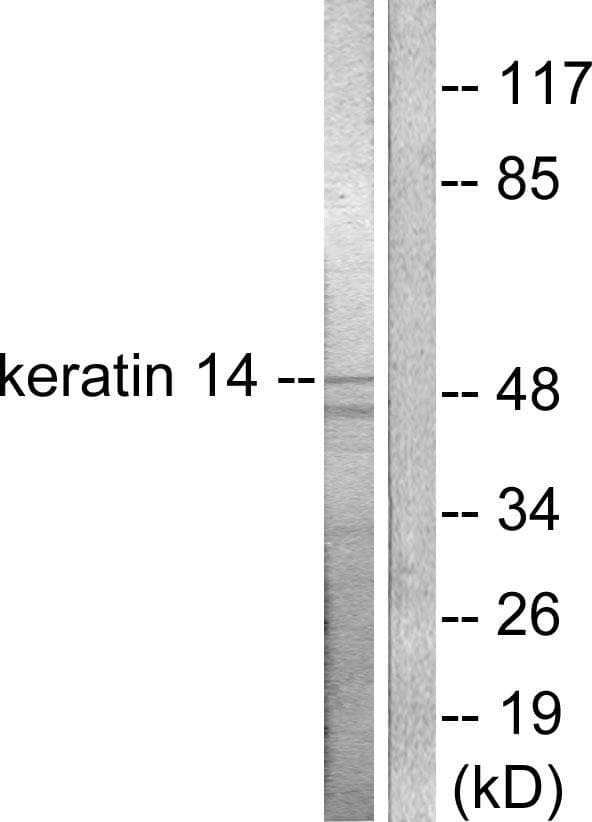Polyclonal Rabbit anti-Human KRT14 / CK14 / Cytokeratin 14 Antibody (IHC, IF, WB)