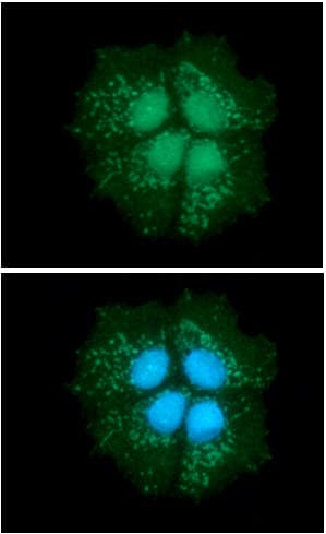 DECR1 Antibody (clone AT3B2)