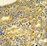 Polyclonal Rabbit anti-Human Dipeptidylpeptidase 8 / DPP8 Antibody (aa846-876, IHC, WB)