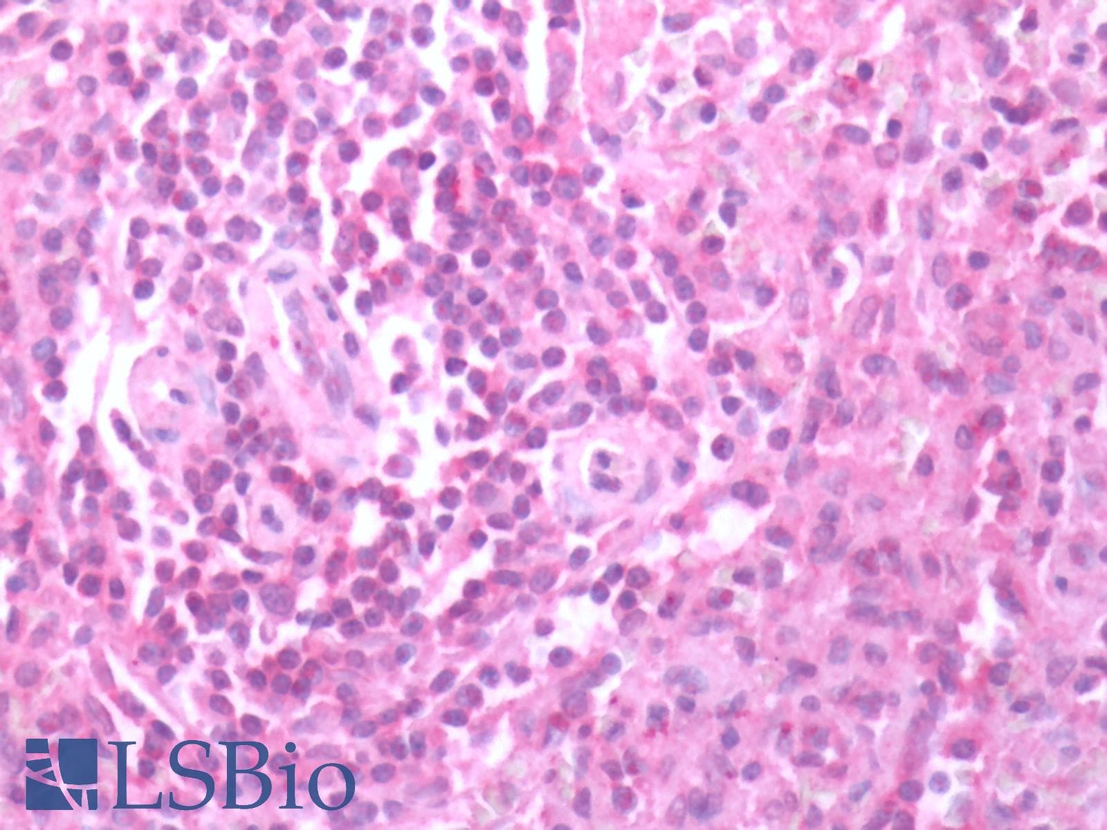 PathPlus™ Polyclonal Rabbit anti-Human CXCR3 Antibody (C-Terminus, IHC)