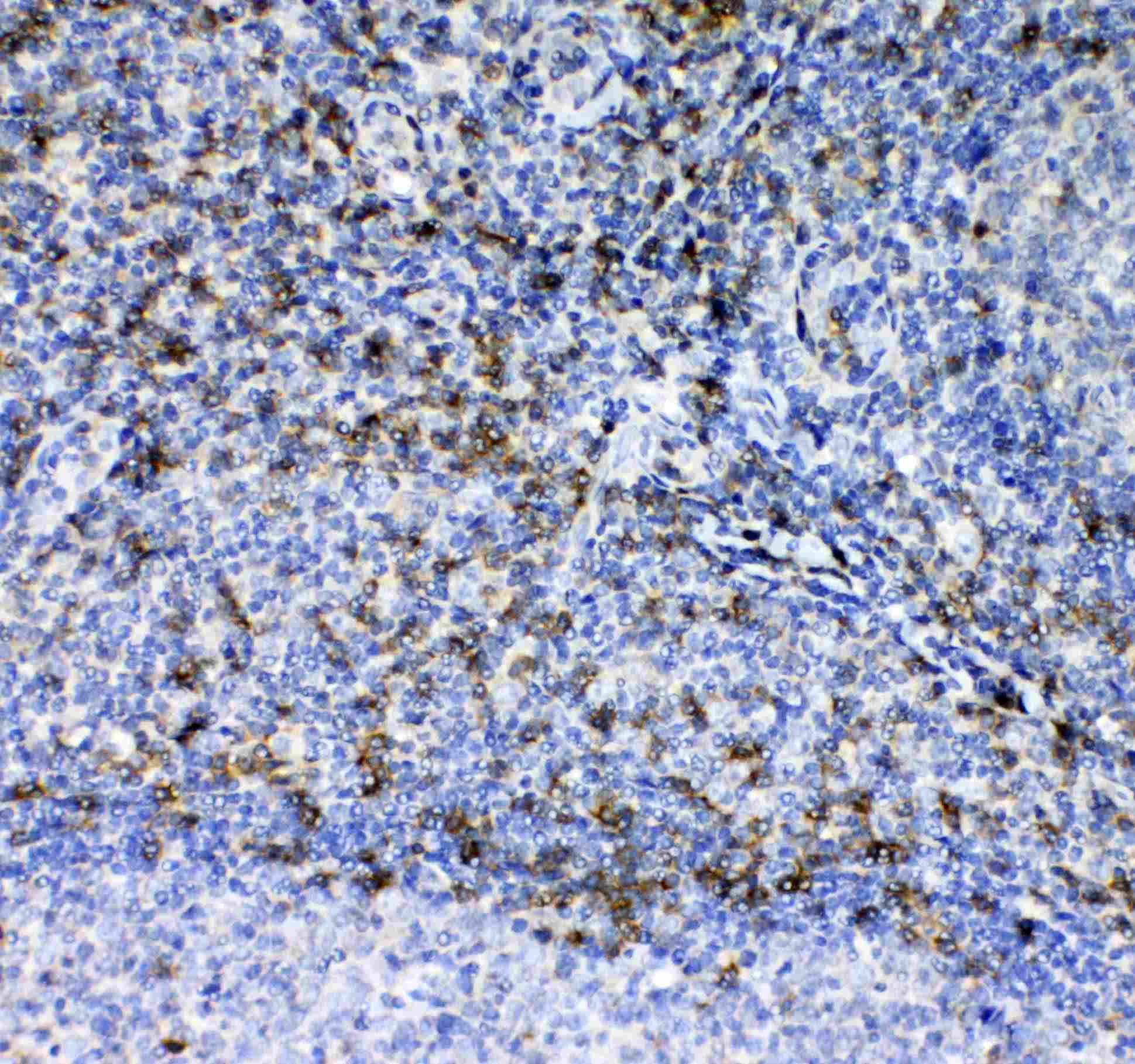 CD7 Antibody